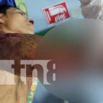 El Rama: Con una mano cercenada resultó un hombre en celebración de año nuevo