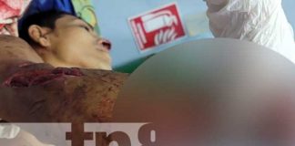El Rama: Con una mano cercenada resultó un hombre en celebración de año nuevo