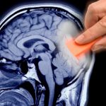 Descubre los alimentos que podrían estar afectando tu memoria Foto: ¿Sabías que tu dieta influye en tu memoria? /cortesía