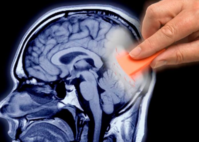 Foto: ¿Sabías que tu dieta influye en tu memoria? /cortesía