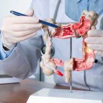 Foto: Colon sano, vida plena /cortesía