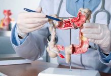 Cuida tu colon: Hierbas medicinales que deberías conocer Foto: Colon sano, vida plena /cortesía