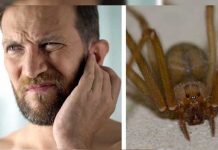 Descubren una araña con todo y su nido dentro del oído de un hombre