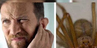 Descubren una araña con todo y su nido dentro del oído de un hombre