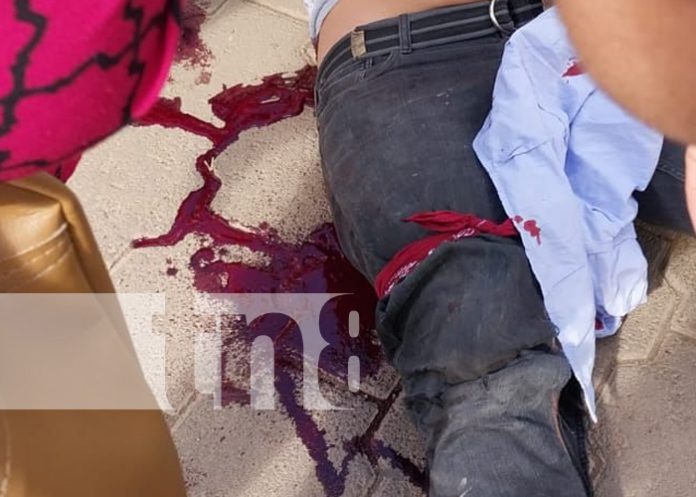 Foto: Motociclista y vendedor de helado lesionados por accidentes en Juigalpa/TN8