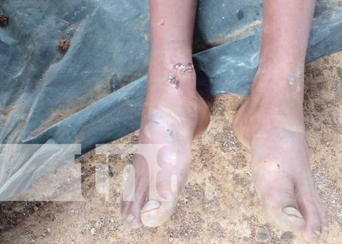 Perdió la vida en empresa de electricidad ENATREL