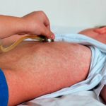 Foto: OMS insta a acción urgente /cortesía