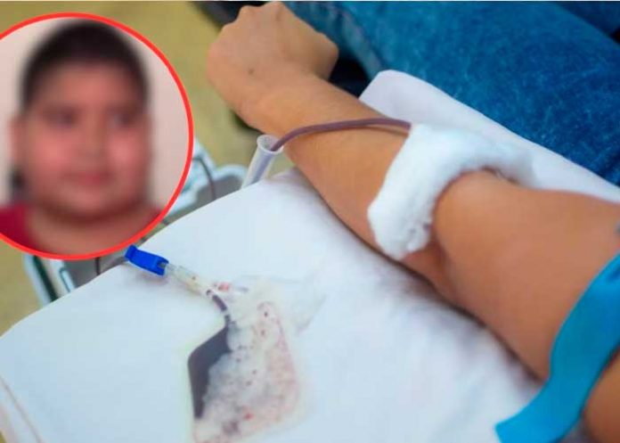 cancer3 Menor con cáncer renuncia a sus quimioterapias