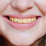 ¿Andás los dientes como mazorca de amarillos? Esta es la receta para limpiarlos Remedio casero que “barre” el color amarillo de los dientes