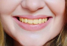 Remedio casero que “barre” el color amarillo de los dientes