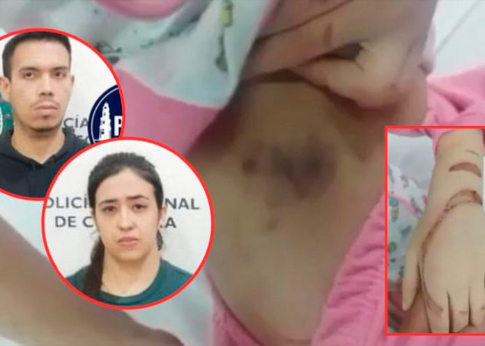 Niños golpeados por su madre y padrastro en Colombia