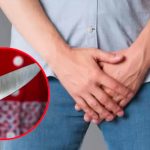 Loca de celos por una infidelidad le mutiló el «pajarito» a su esposo en Perú Investigan en Perú a mujer que mutiló el pene de su pareja