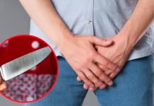 Investigan en Perú a mujer que mutiló el pene de su pareja