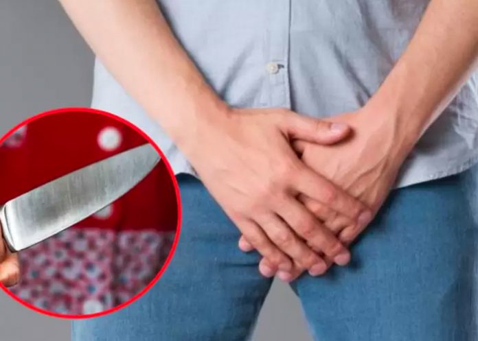 Investigan en Perú a mujer que mutiló el pene de su pareja