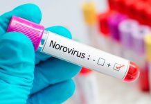 ¡Alerta! Aumentan brotes de norovirus en Estados Unidos