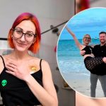 Conoce el Síndrome de Ehlers-Danlos: Allison Tennyson es alérgica al semen ¿De qué trata? Síndrome de Ehlers-Danlos: Mujer es alérgica al semen