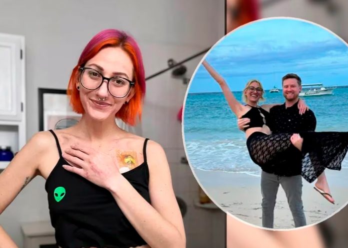 ¿De qué trata? Síndrome de Ehlers-Danlos: Mujer es alérgica al semen