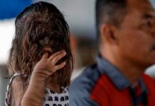 Adik Missclyen la historia de la niña con 'síndrome de hombre lobo'