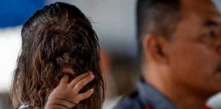 Adik Missclyen la historia de la niña con 'síndrome de hombre lobo'