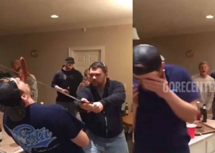 1 Corta la nariz de su amigo con una espada, todo por hacer un reto viral