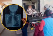 Niña se atraganta con moneda en su primer día de clases en Cusco, Perú