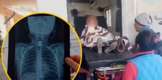 Niña se atraganta con moneda en su primer día de clases en Cusco, Perú