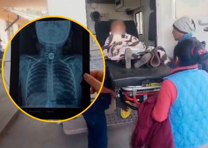 Niña se atraganta con moneda en su primer día de clases en Cusco, Perú