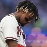 Acuña estaría listo para día inaugural; será examinado Ronald Acuña estaría listo para el día inaugural