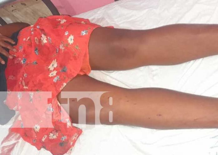 Foto: Terrible agresión a machetazos a unas mujeres en Waspam, Caribe de Nicaragua / TN8