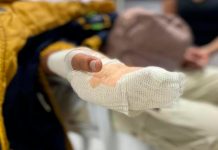 Sufre quemaduras del 76% tras experimento escolar