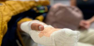 Sufre quemaduras del 76% tras experimento escolar