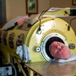 Vivió más de 70 años en un pulmón de acero