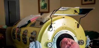 Vivió más de 70 años en un pulmón de acero