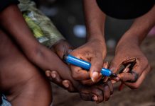 19 niños fallecen por complicaciones de sarampión en el noreste de Nigeria Foto: 19 niños fallecen por complicaciones de sarampión en el noreste de Nigeria / Cortesía