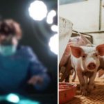 China realiza primer trasplante de riñón de cerdo a un ser humano China realiza primer trasplante de riñón de cerdo a un ser humano