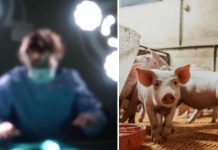 China realiza primer trasplante de riñón de cerdo a un ser humano