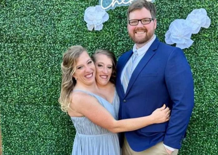 Abby Hensel una gemela siamesa se casó ¿Cómo es la vida de la otra?