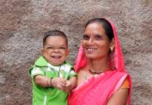 Asombroso: Hombre de India mide tan solo 24 pulgadas por una extraña enfermedad Hombre en India mide tan solo 24 pulgadas