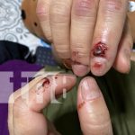 «Me servís más muerta que viva», denuncia por intento de femicidio a su esposo en Managua "Me servís más muerta que viva", denuncia por intento de femicidio a su esposo en Managua