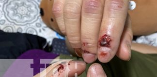 "Me servís más muerta que viva", denuncia por intento de femicidio a su esposo en Managua