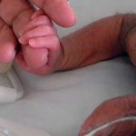 «Comí un gato estando embarazada» Niño nace con síndrome del hombre lobo Niño nace con síndrome del hombre lobo en Filipinas