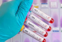OMS está alarmada por el aumento de las Infecciones de Transmisión Sexual OMS advierte aumento en infecciones de transmisión sexual