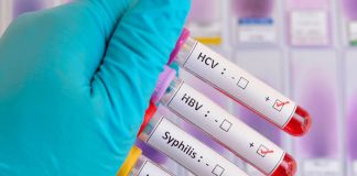 OMS advierte aumento en infecciones de transmisión sexual