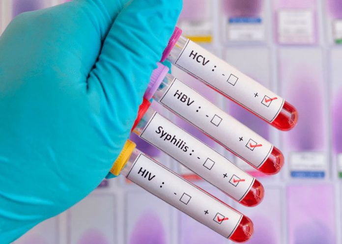 OMS advierte aumento en infecciones de transmisión sexual OMS advierte aumento en infecciones de transmisión sexual