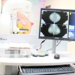 Foto; Hospital Alemán nicaragüense Carlos Marx Celebra la inauguración de un nuevo equipo mamográfico/ TN8