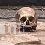 Encuentran cráneo humano en plena vía pública en San Marcos, Carazo Foto: Encuentran cráneo humano en plena vía pública en San Marcos, Carazo/TN8