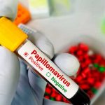 Inicia en Nicaragua la jornada de la segunda dosis contra el virus del VPH Foto: Inicia en Nicaragua la jornada de la segunda dosis contra el virus del VPH / Cortesía