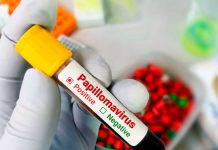 Foto: Inicia en Nicaragua la jornada de la segunda dosis contra el virus del VPH / Cortesía