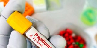 Foto: Inicia en Nicaragua la jornada de la segunda dosis contra el virus del VPH / Cortesía
