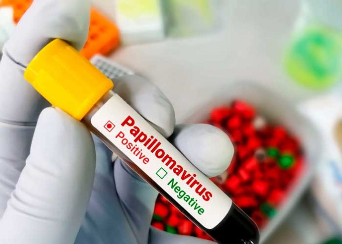 1 Foto: Inicia en Nicaragua la jornada de la segunda dosis contra el virus del VPH / Cortesía